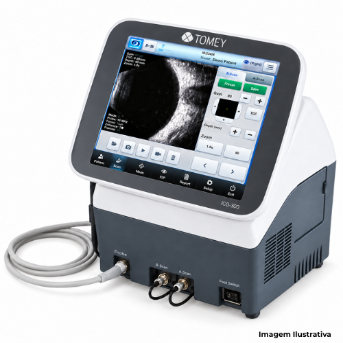 Ultrassom Oftalmológico Tomey UD-800 AB+UBM - Portal de Adesões